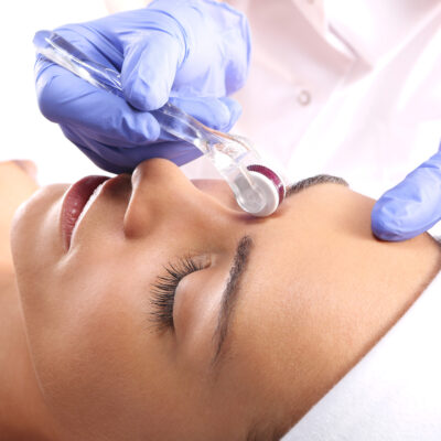 VTCT (ITEC) Level 4 Award in Skin Needling