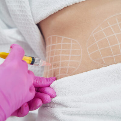 ProQual Level 6 Certificate in Non-Surgical Fat Reduction