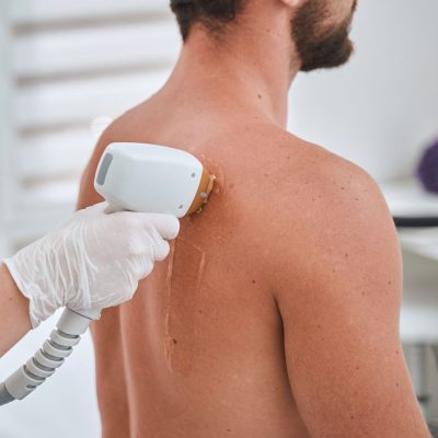 ProQual Level 4 Diploma in Laser, IPL and Electrical Treatments